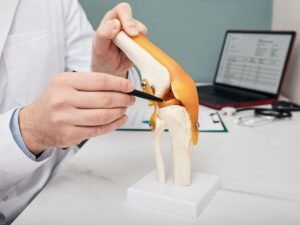 Doctor explaining meniscal tear anatomy of the knee joint