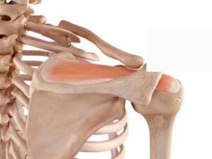 Rotator Cuff Injuries - Supraspinatus Tendon