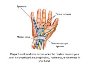 Anatomy of the carpal tunnel showing the median nerve, flexor tendons, and surrounding structures. Created by Physio Soton for educational purposes.
